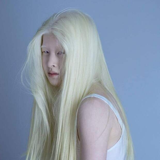 Meet-Chinese-Xueli-Abbing-the-albino-abandoned-when-she-was-a-baby-who-became-a-Vogue-model-60910135c4bf3__700.jpg