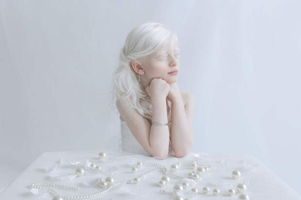 Яли альбиносы, красота, люди, фото, фотограф, фотопроект, цвет кожи