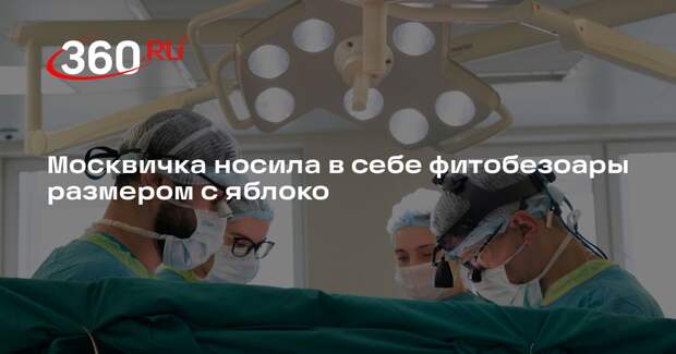 Московские врачи удалили из желудка женщины фитобезоары размером с яблоко