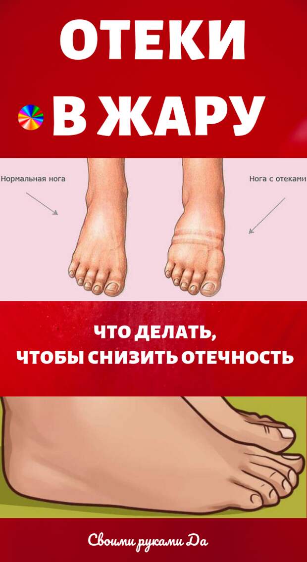 Здоровье: Что делать, чтобы снизить отеки в жару? Народные рецепты в домашних условиях летом.
