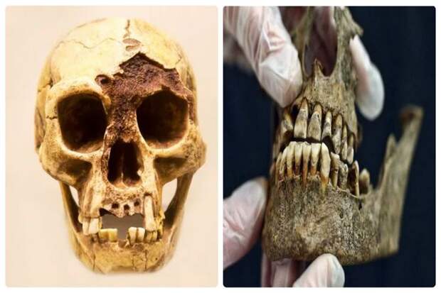 При этом, когда находят скелеты, которые находились в земле, скажем, 2000 лет, и у них есть зубы, они обычно находятся в очень хорошем состоянии. Так почему же тогда наши зубы повреждаются и требуют регулярного внимания? Похоже, что стоматология в старые времена не была хорошей карьерой!