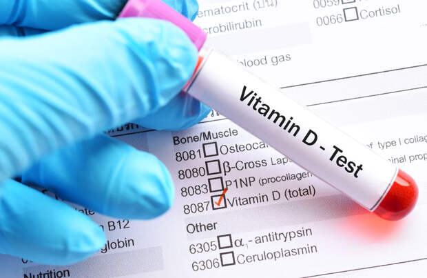 vitamin-D-test-total