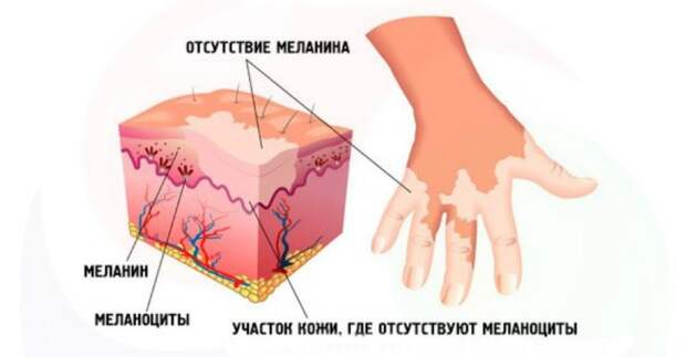 схема