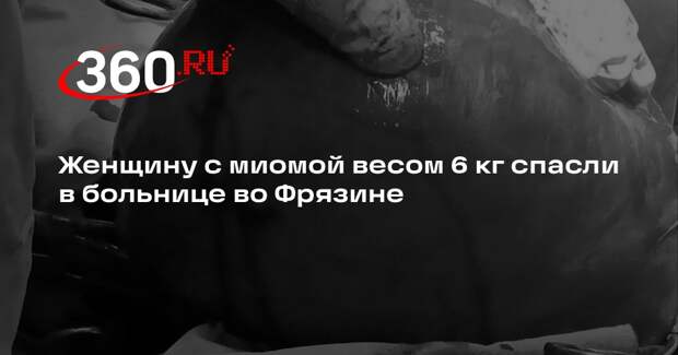 Женщину с миомой весом 6 кг спасли в больнице во Фрязине