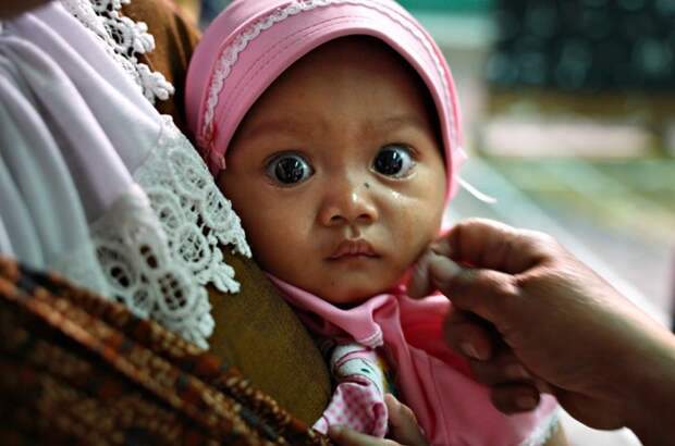 Индонезийская малышка после процедуры обрезания Дети Мира, подборка, подборка фото, фото