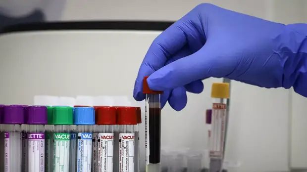 Вирусолог прокомментировал сообщения о новой для Норвегии разновидности COVID-19