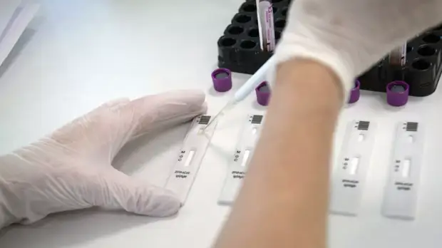 В Минздраве оценили ситуацию с коронавирусом в России