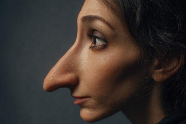 Работа над самооценкой: как избежать эффекта «ожидание/реальность», решившись на пластику?