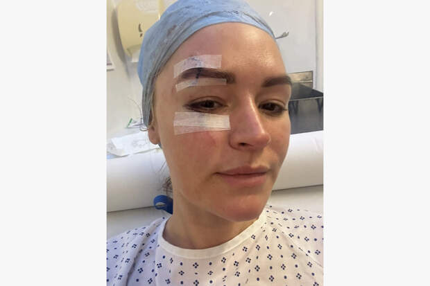 Известная телеведущая рассказала о неуверенности в себе из-за шрамов на лице