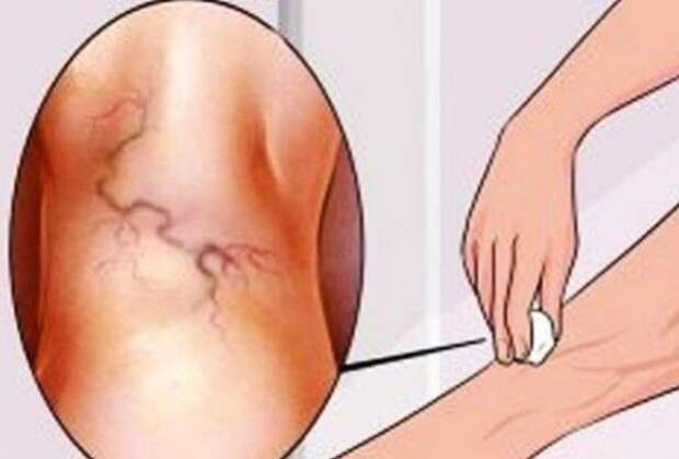 Простой и эффективный метод даёт отличные результаты!