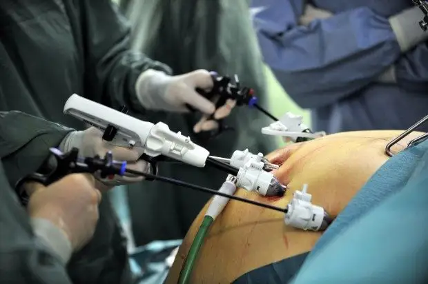 Скальпель - не волшебная палочка