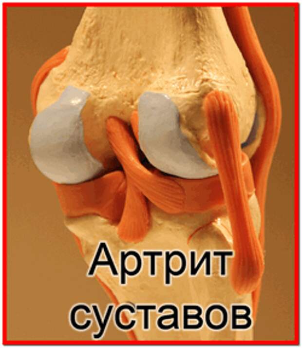 Лечение суставов