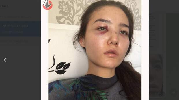 Новый скандал в Казахстане: возбуждено дело на дипломата, 10 лет избивавшего жену