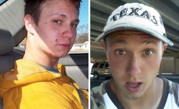 Преображения бывших наркоманов (21 фото)