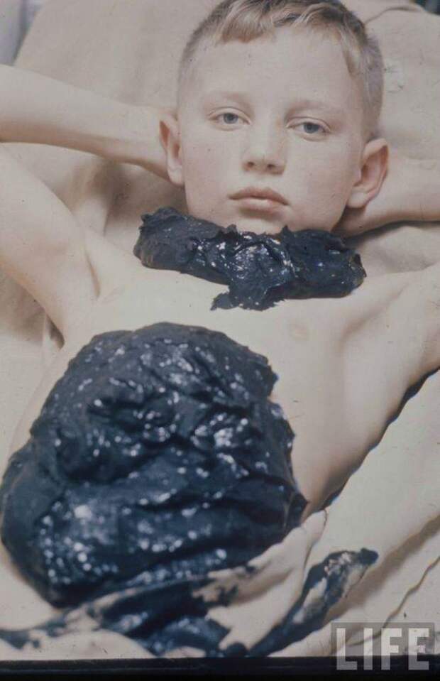 Советская медицина в фотографиях