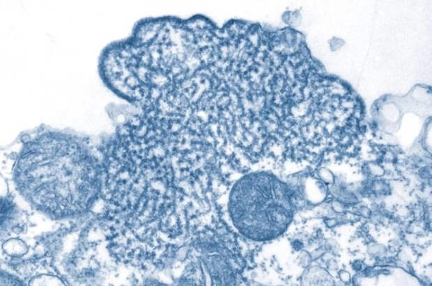 Учёные КНР заявили, что нашли препарат, способный побороть вирус Нипах