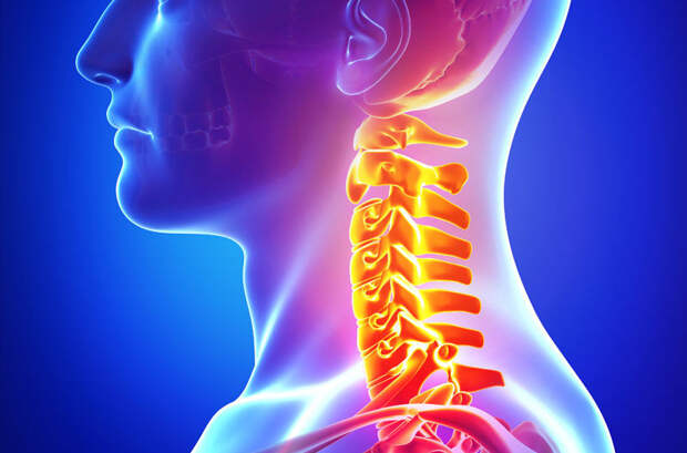 Картинки по запросу neck pain x ray