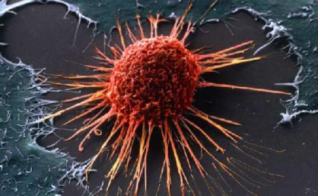 Картинки по запросу клетки рака под микроскопом