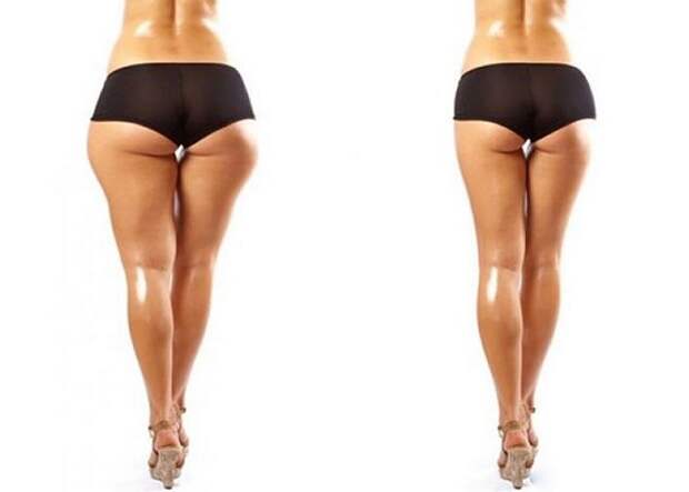 Как скрыть ушки на бедрах при помощи одежды Как скрыть ушки на бедрах при помощи одежды