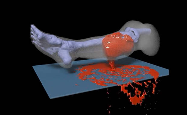 Смоделированная ситуация: пуля попала в ногу. Смоделированная ситуация: пуля попала в ногу.