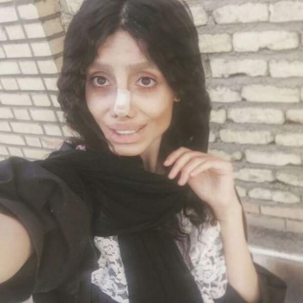 Иранка горела желанием превратиться в Анджелину Джоли Сахар Табар, анджелина джоли, внешность, изменение, иран, лицо, операция, пластика, фигура