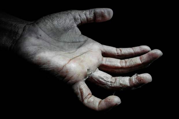 Жители Ленобласти жалуются на гниющего в квартире мужчину