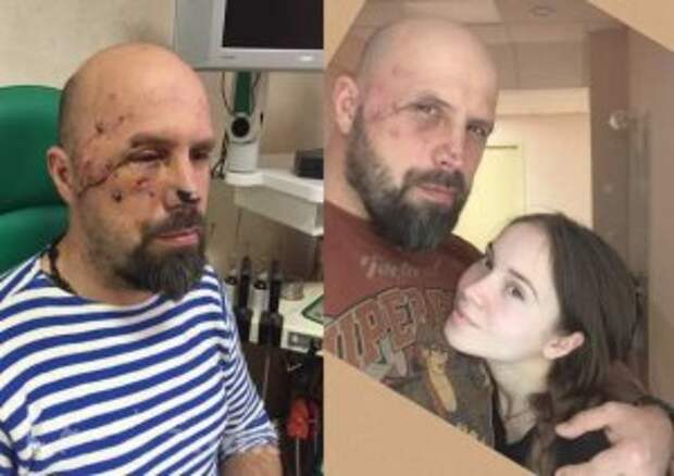 Под Пальмирой был тяжело ранен ветеран спецназа ВДВ, певец Вячеслав Корнеев