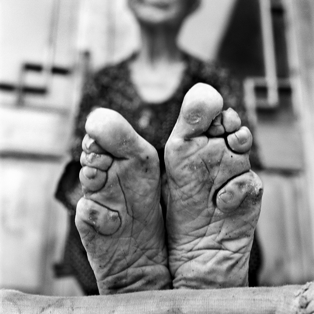 lastfootbinding01 Последние живые китаянки с лотосными ножками