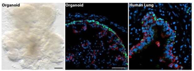 Создание искусственных легких. Сравнение тканей настоящих легких с искусственными под микроскопом. Источник изображения: livescience.com. Фото.