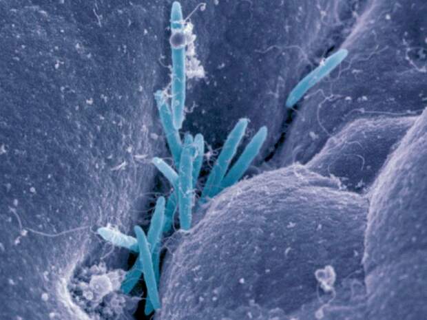 A new study finds that members of a common class of gut bacteria, Clostridia, can counter sensitivity to peanuts.