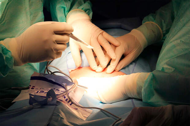 В Краснодаре онкологи спасли пациентку с опухолью, поразившей несколько органов