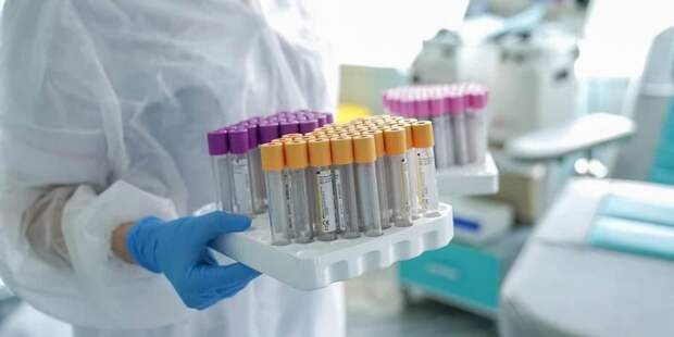 В Москве провели более 20 миллионов ПЦР-тестов на коронавирус