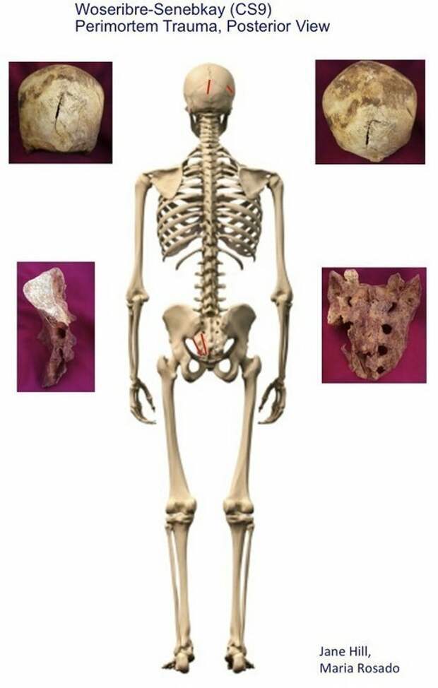 Скелет Сенебкея сзади, красным отмечены следы ударов, по бокам кости со следами ран. археология, древний египет, интересно, история, наука