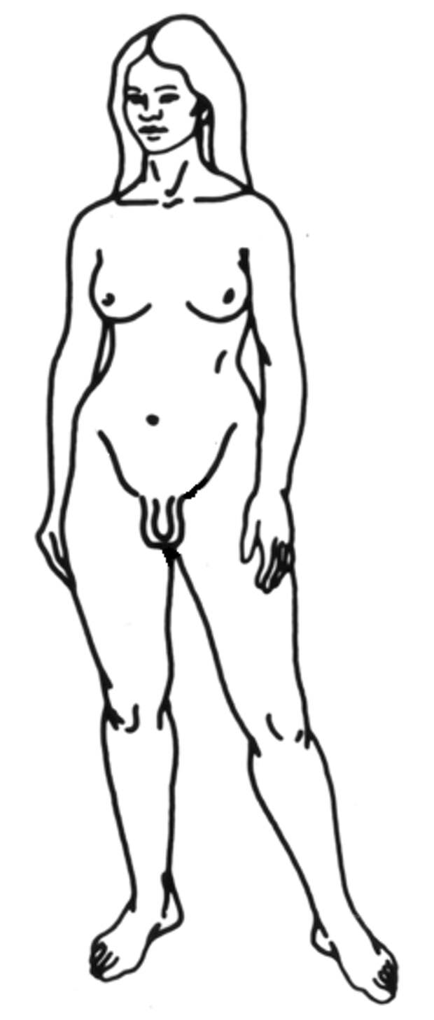 gynandromorphy