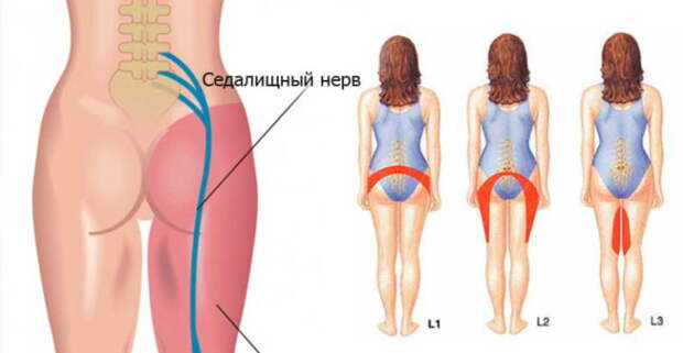 Если ноги стали слабыми - ищите причину в позвоночнике!