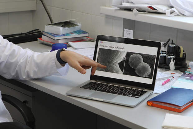 Ученые обратили вспять деменцию, отключив всего один фермент