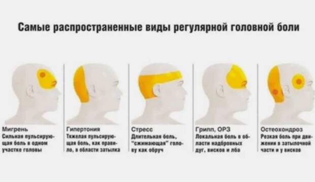 Головная боль