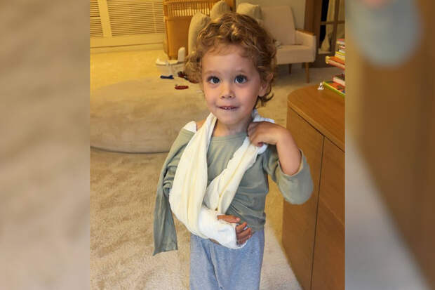 Модель Лена Перминова опубликовала фото сына со сломанной рукой