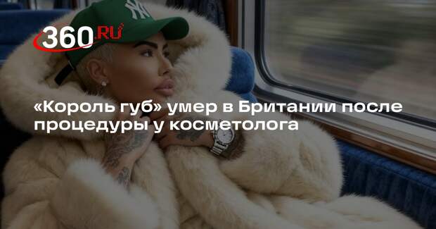 The Sun: «король губ» Джордан Парк умер после процедуры у косметолога