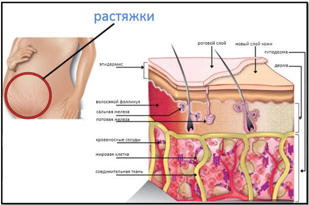 анатомия растяжек