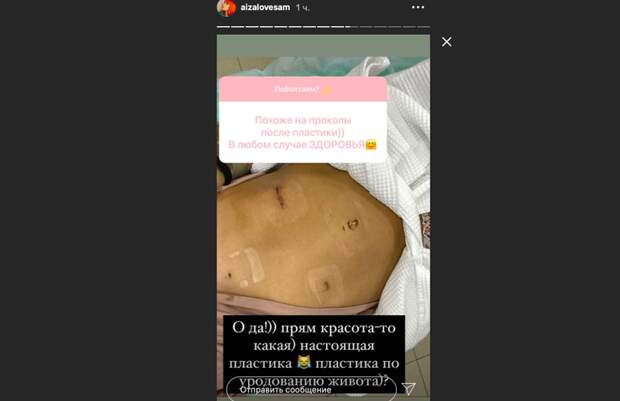 После операции