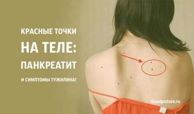 Что означают красные точки на теле