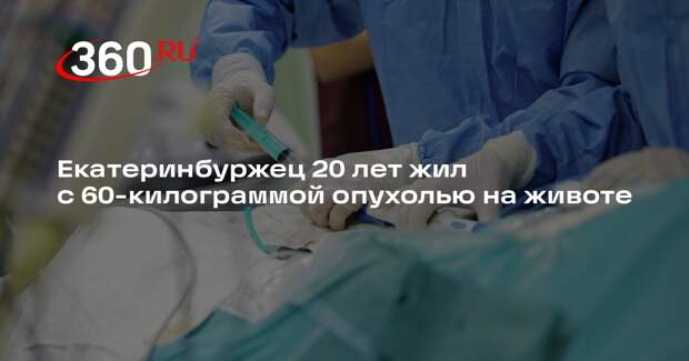 Врачи-онкологи удалили 60-килограммовую опухоль с живота екатеринбуржца