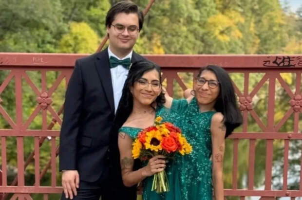 Сиамские близнецы рассказали о своей личной и сексуальной жизни