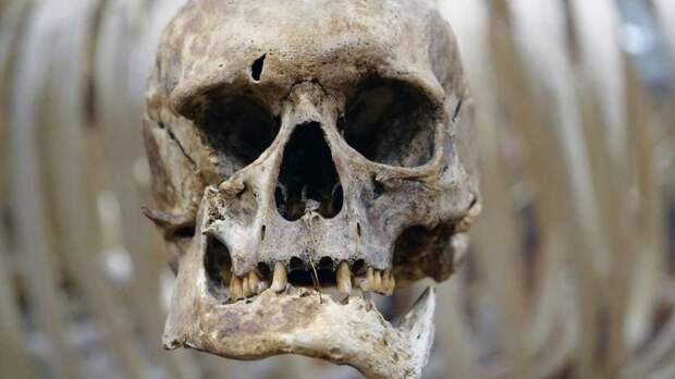 «Разбиватель черепа»: опасная игра подростков выходит из-под контроля