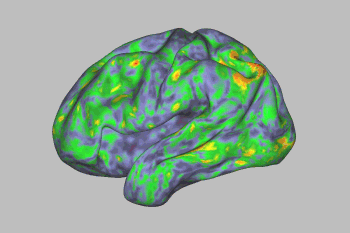 This fMRI brain scan of shows the effects of psilocybin on the brain over time.