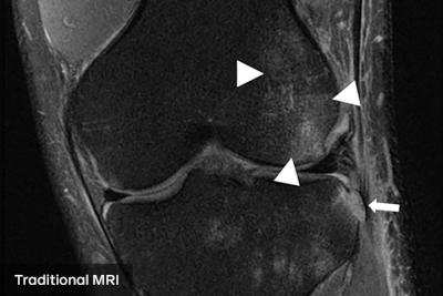 mri