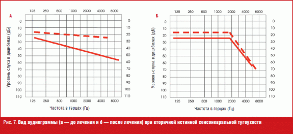 частота нот в герцах таблица. частота шумана. несущий сигнал. диапазон восприятия человека. виды электрических сигналов.